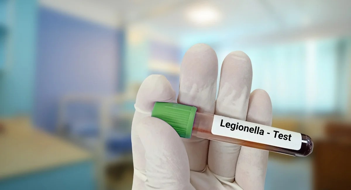 The Upper East Side Legionnaires' Outbreak